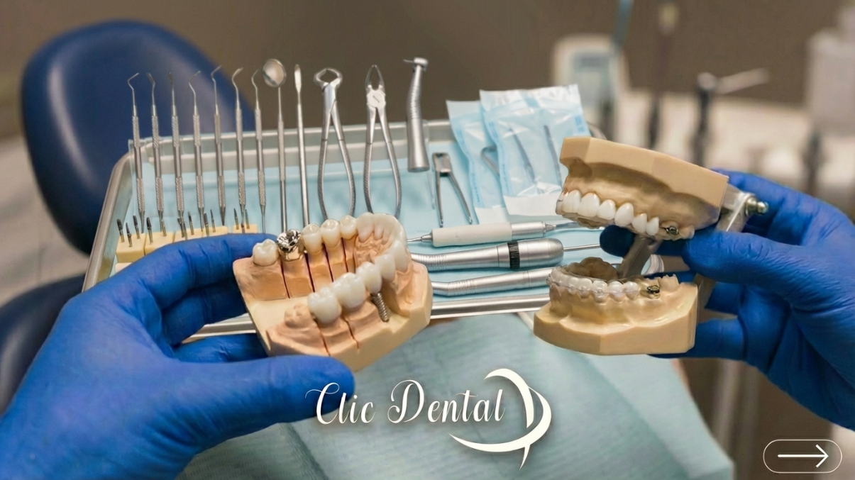 Featured image for “Rehabilitación Oral”